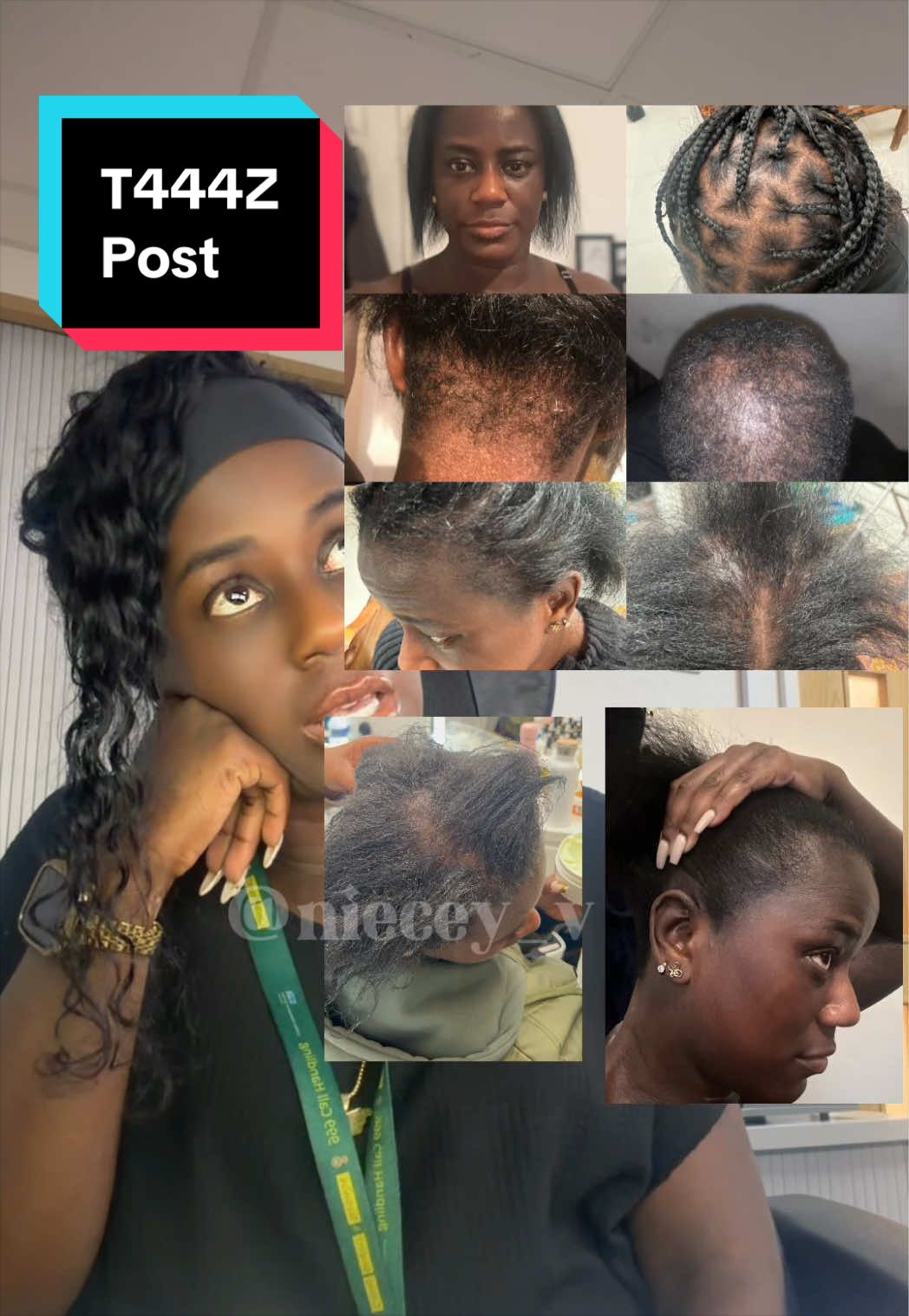 @Niecey | FIT | HAIR | ECZEMA &