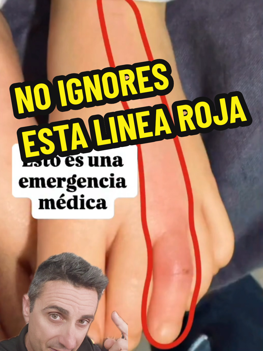 @Miguel ASSAL