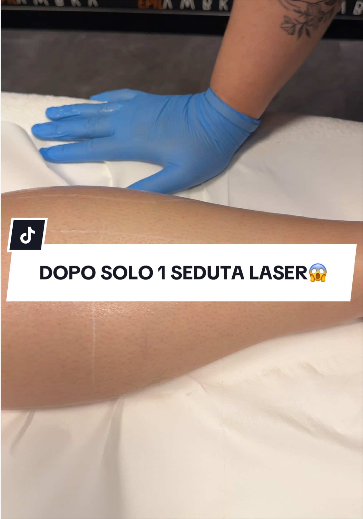@epilambra