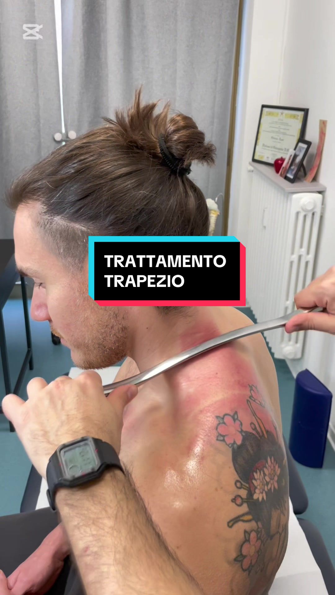 @OsteopataLuca