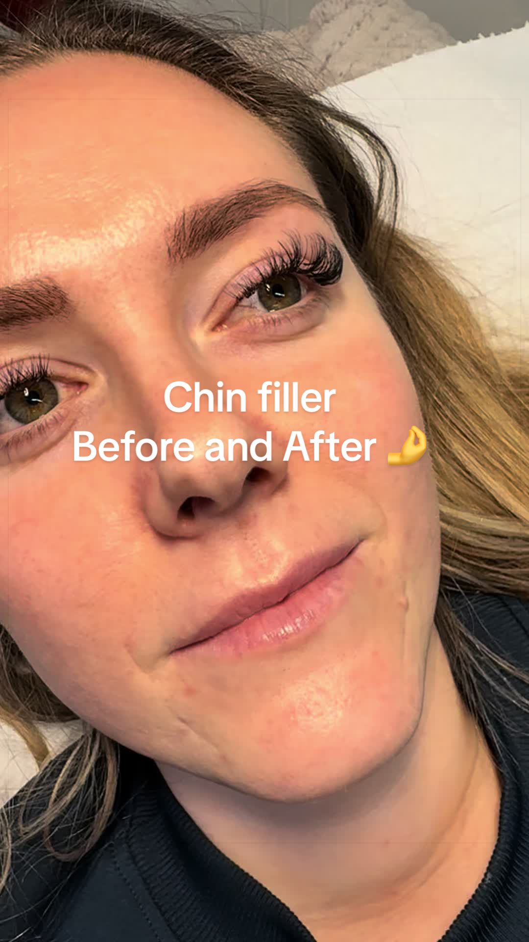 @face_ncl