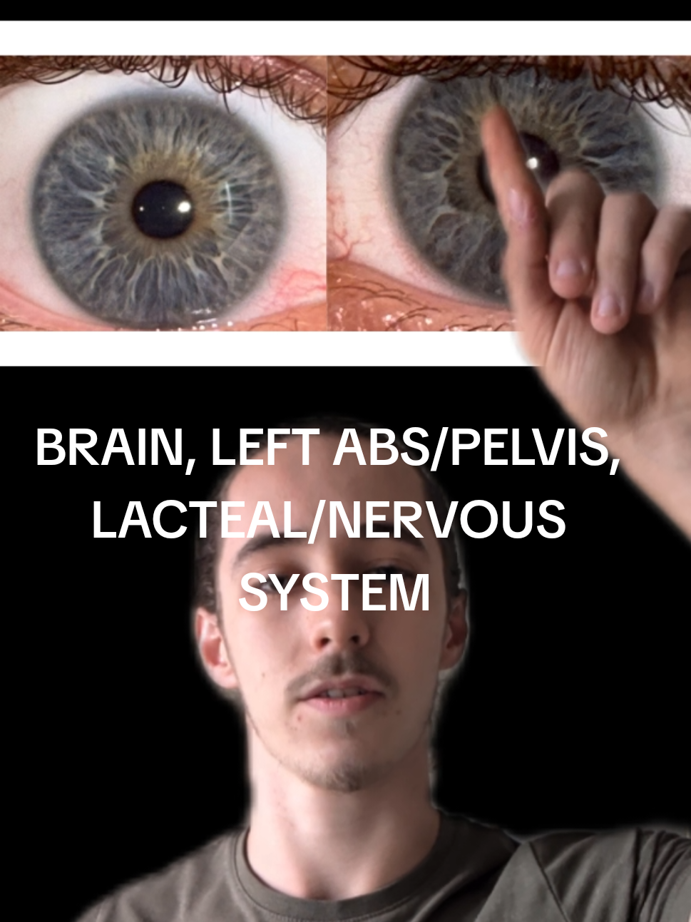 @Oliver | Aajonus' Iridology 👀