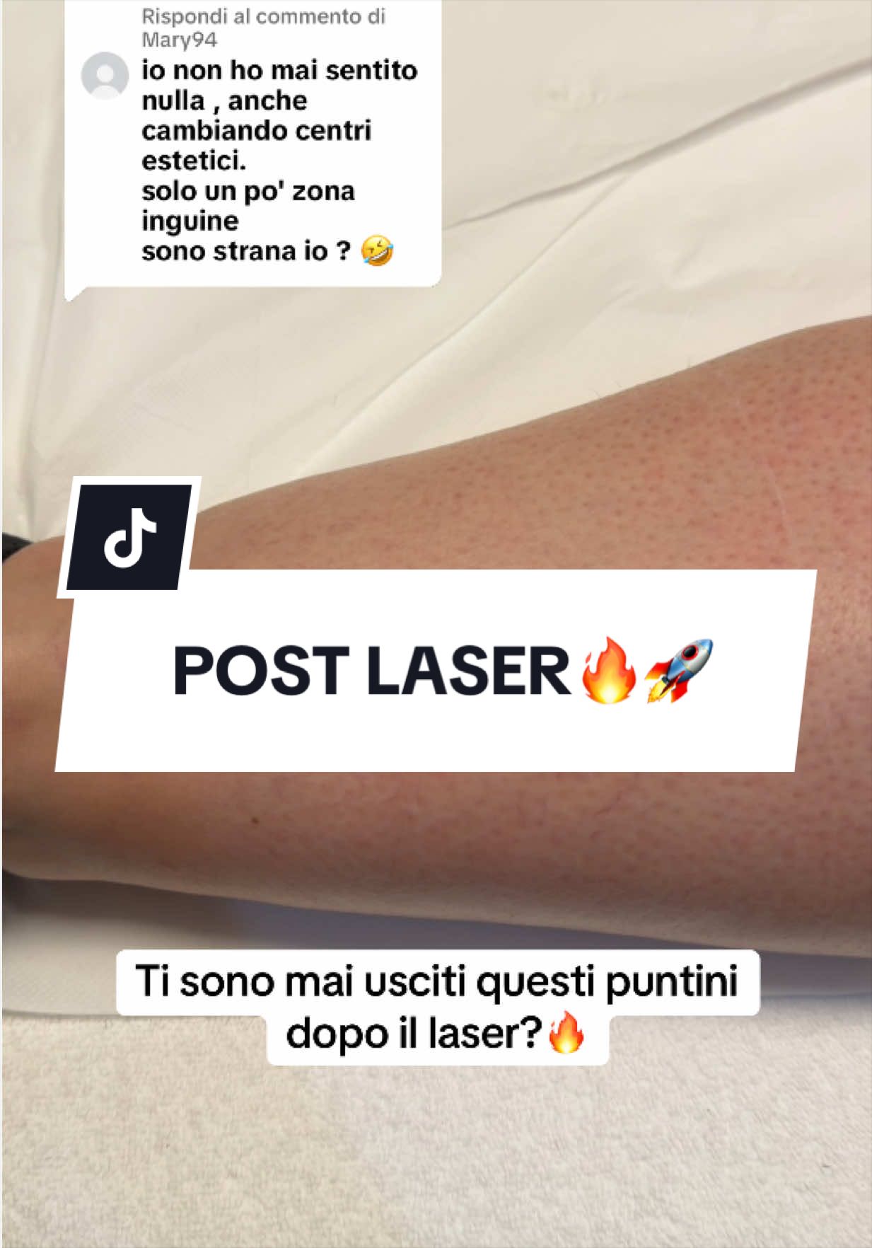 @epilambra