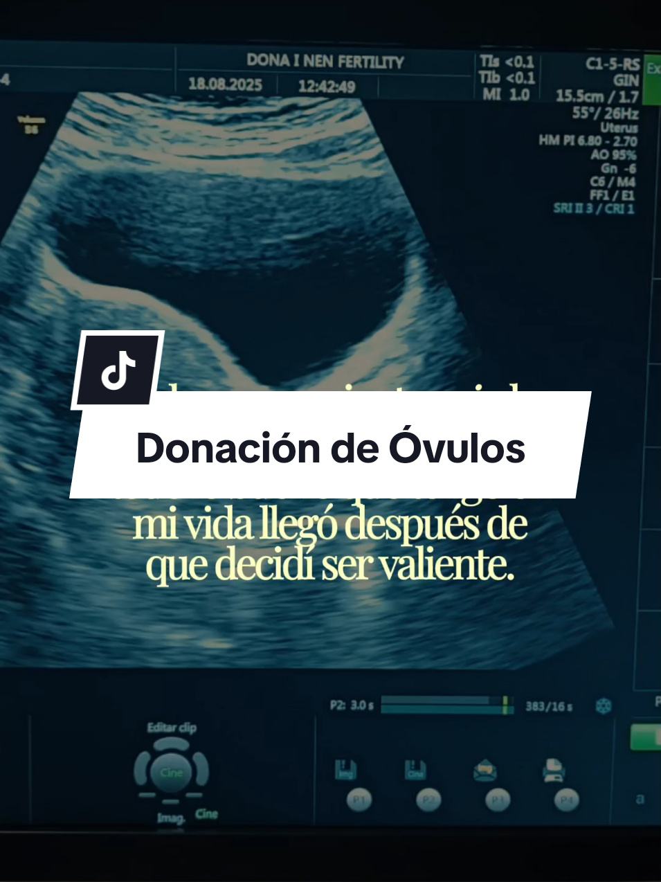@Karen | Fecundación In Vitro