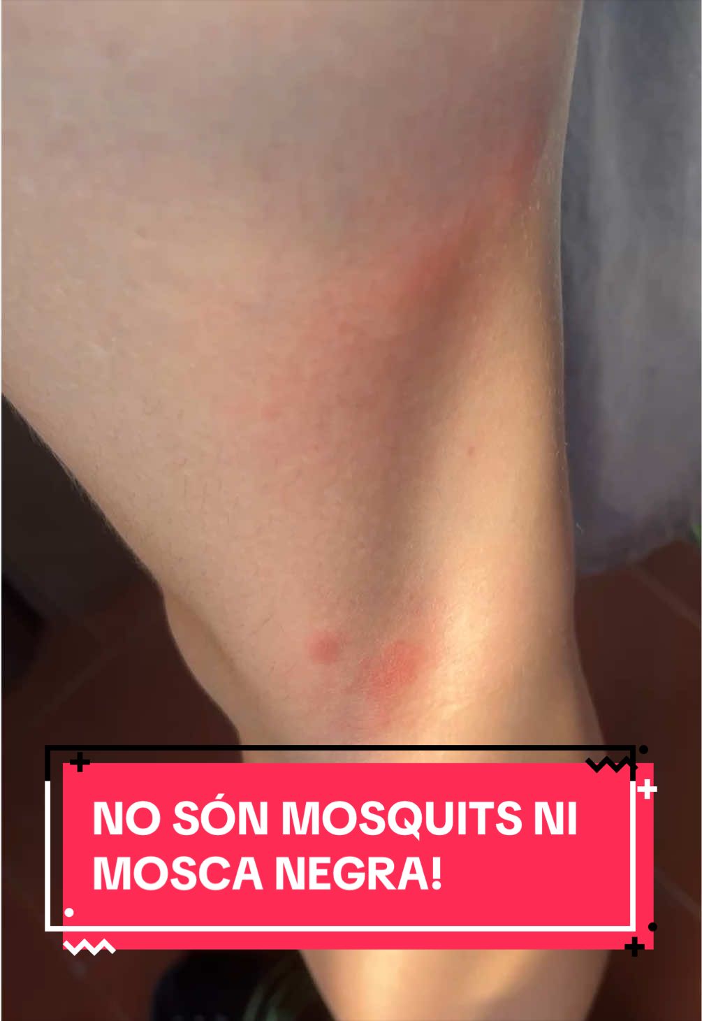 @meduseeta