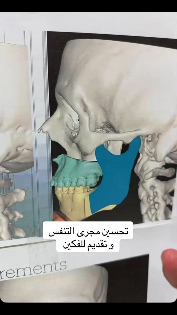 @Dr.Faleh Ali Alshahrani