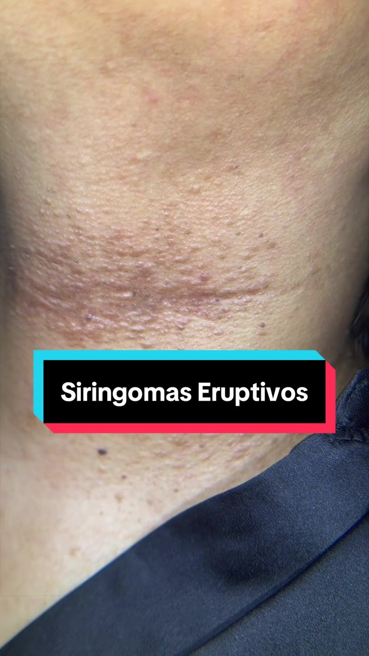 @Dr. Wilfrido Solano Derma