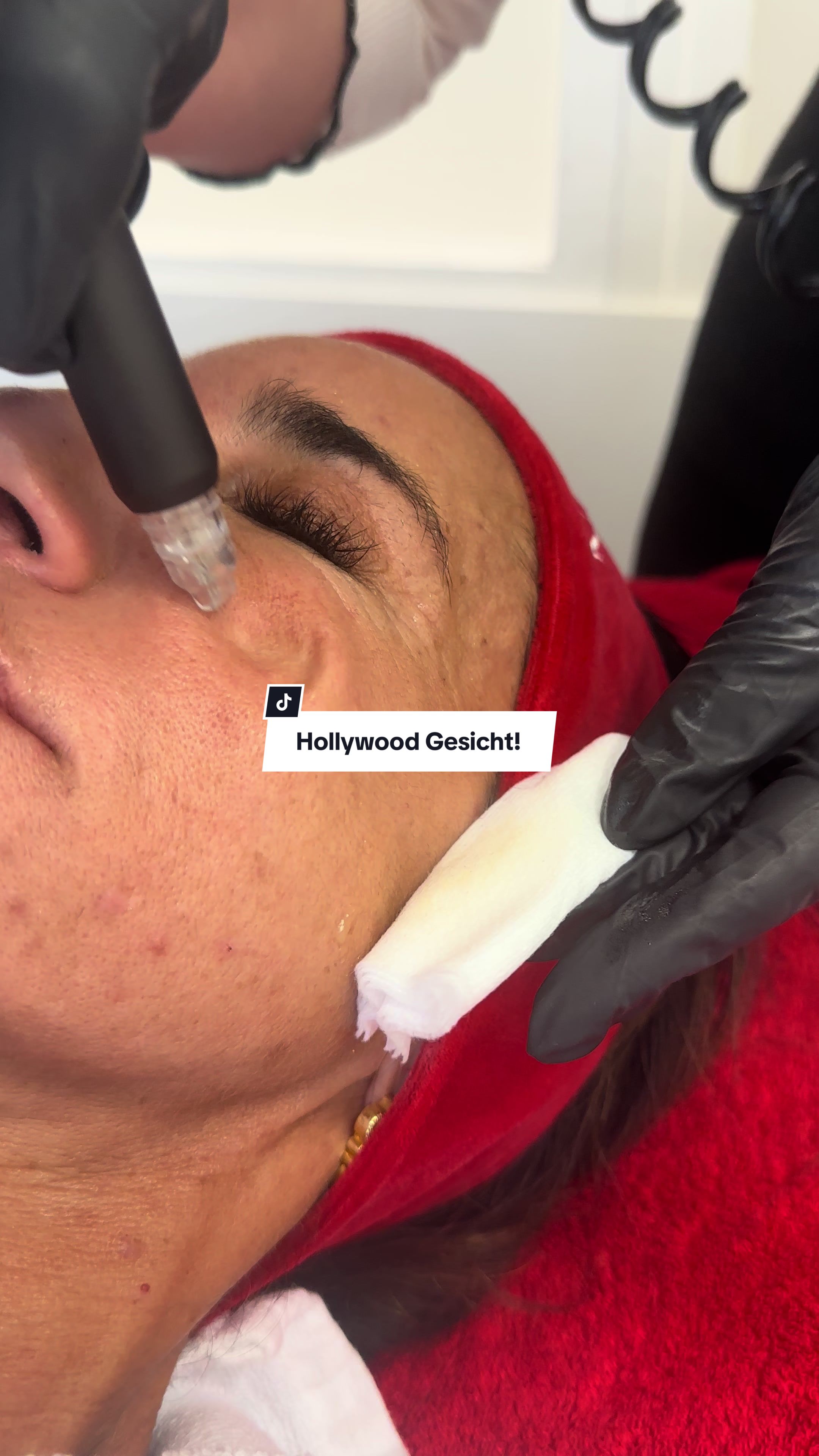@soul_laeseraesthetic