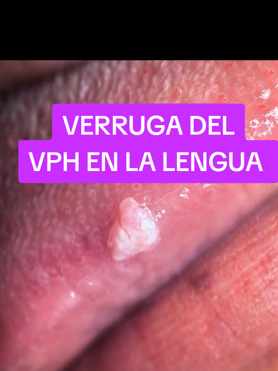 @VPH2025