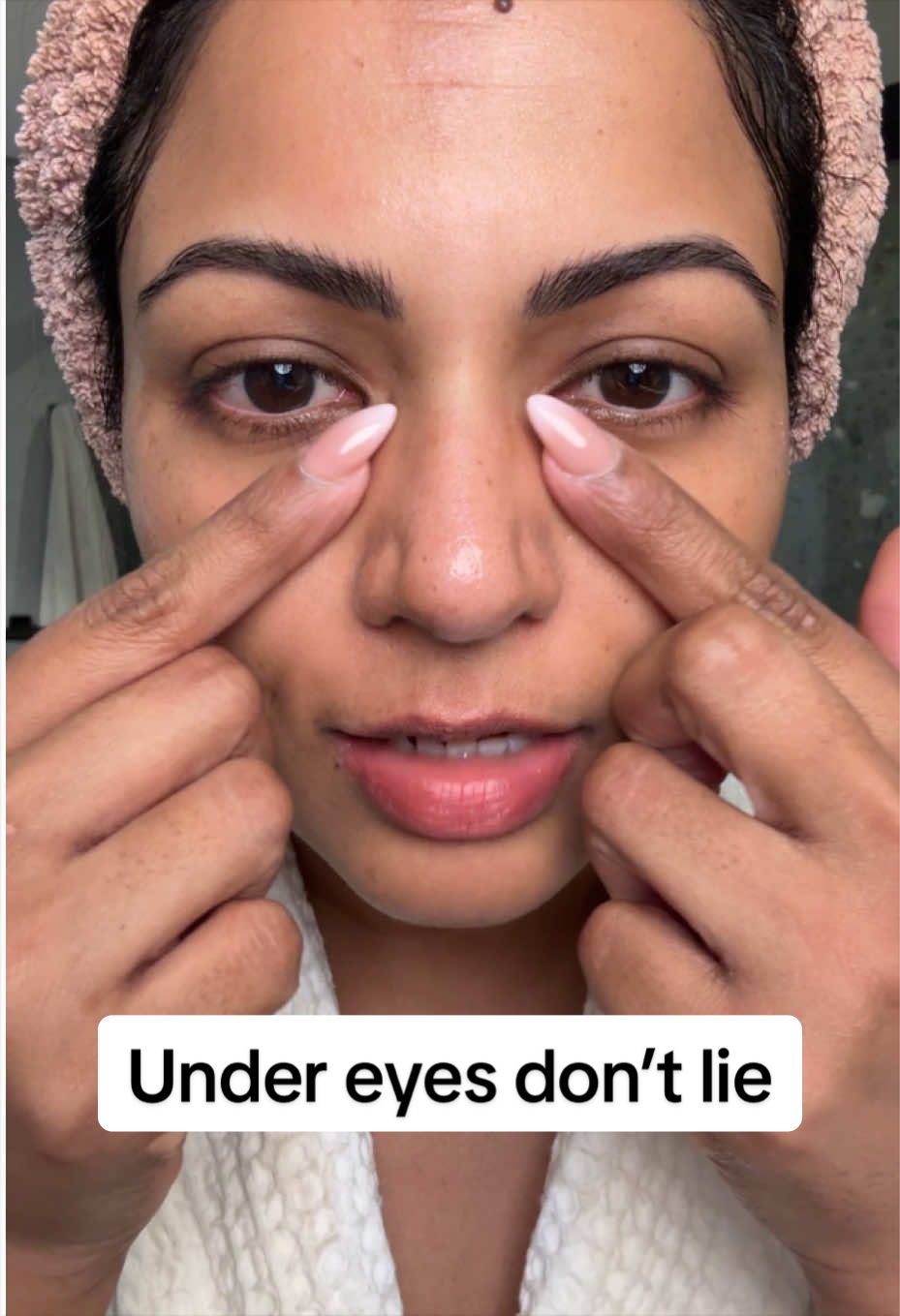 @Dee | Hyperpigmentation