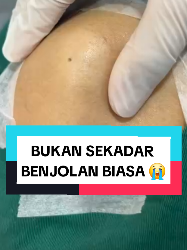 @Rawatan Kulit,Echo,Antenatal