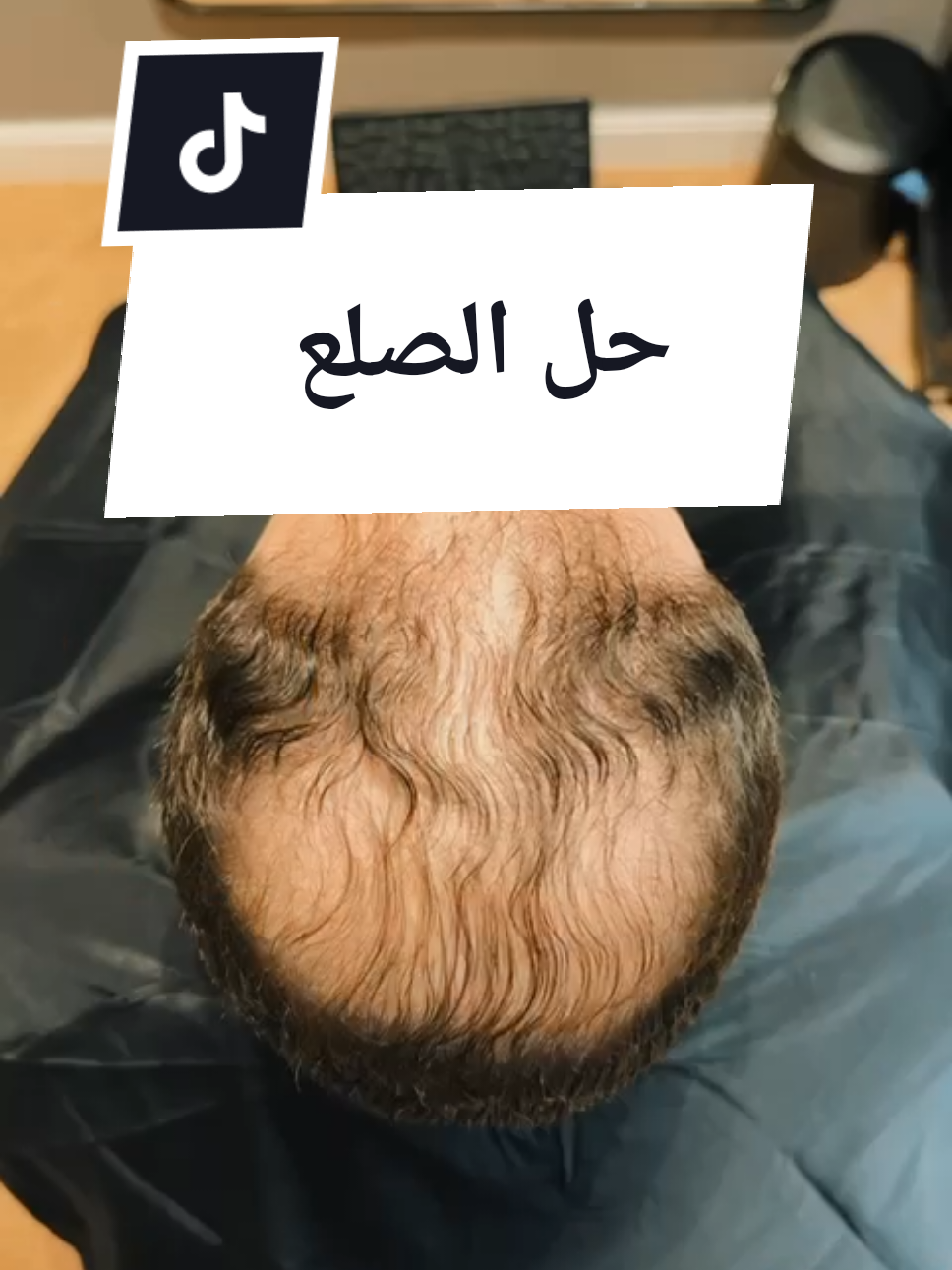 @MesterVaib