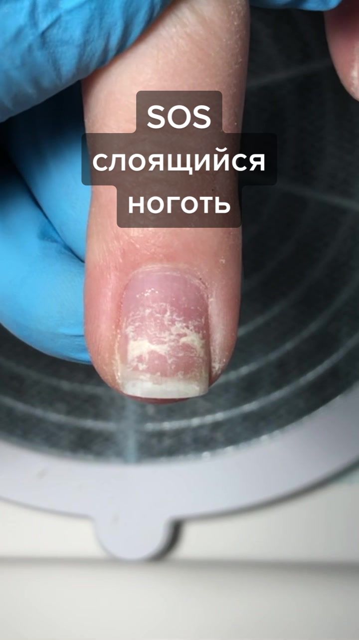 @Лера