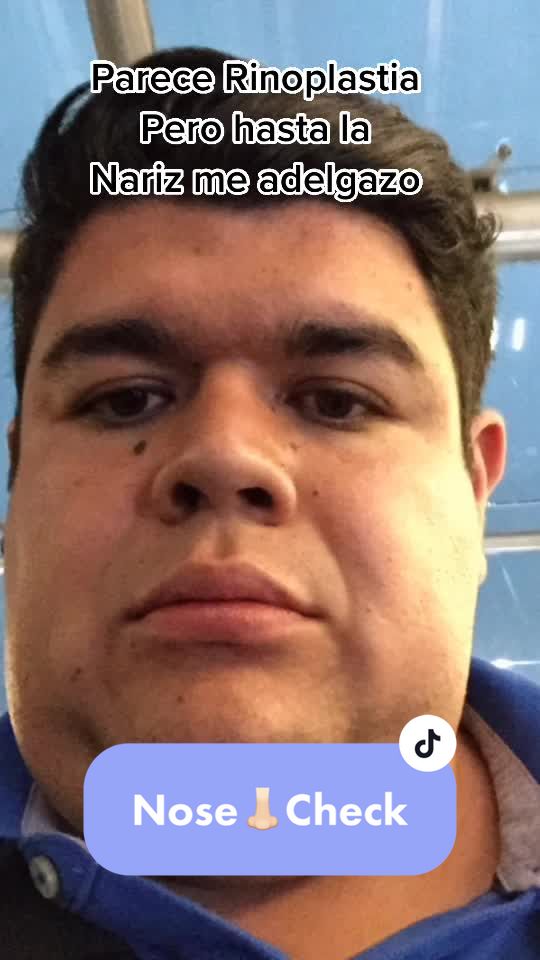 @Arturo Martinez