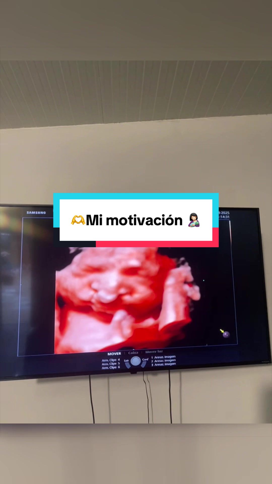 @Rosmary_Suárez