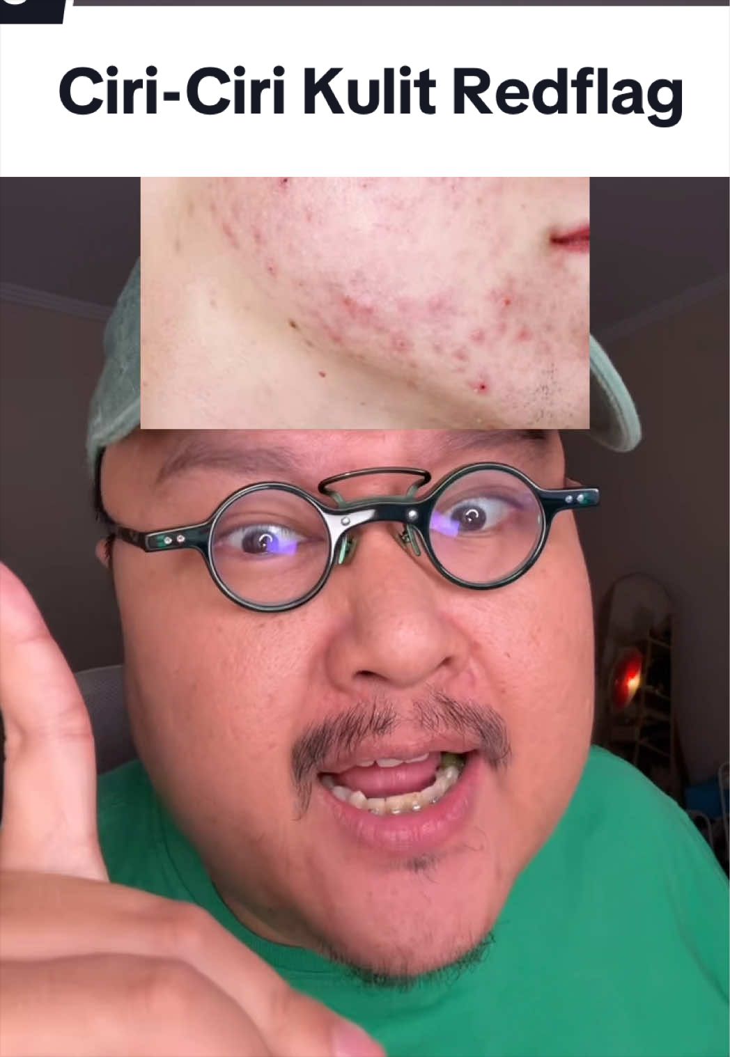 @Ali | @HungryForSkincare