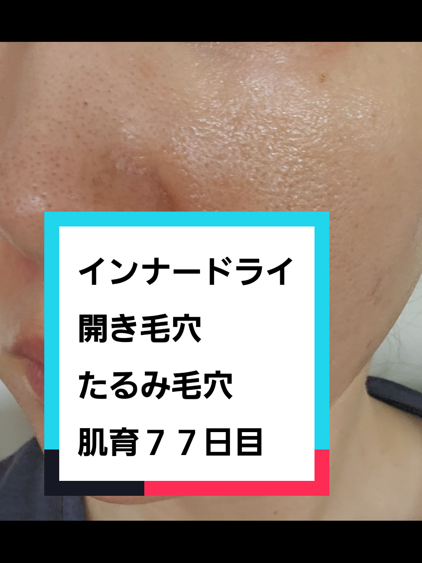 @リアル毛穴改善記録
