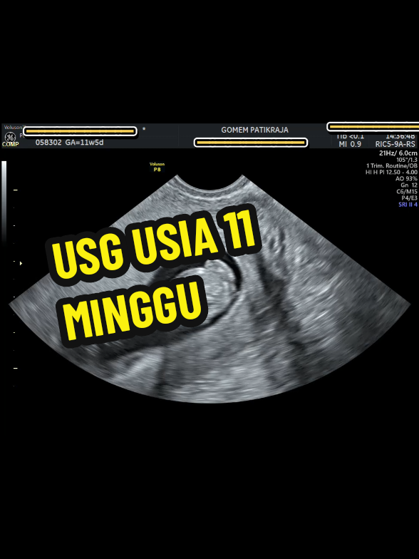 @USG 4D PATIKRAJA