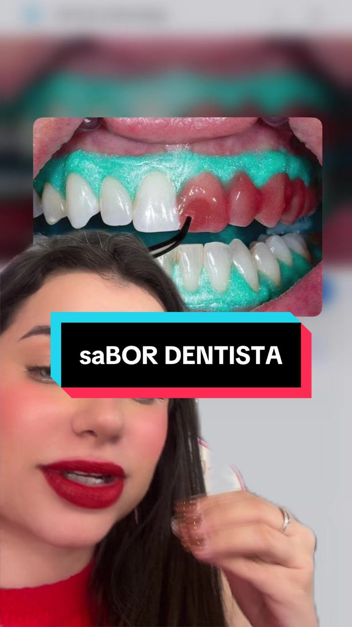 @Manu Froeder