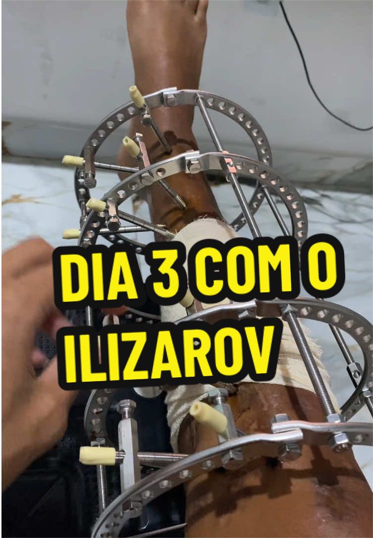 @Halef Henrique
