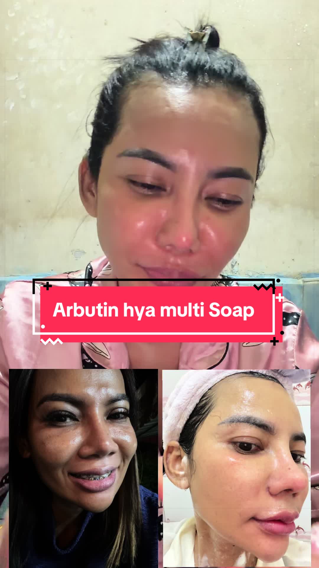 @นัตตี้คือความโชคดี