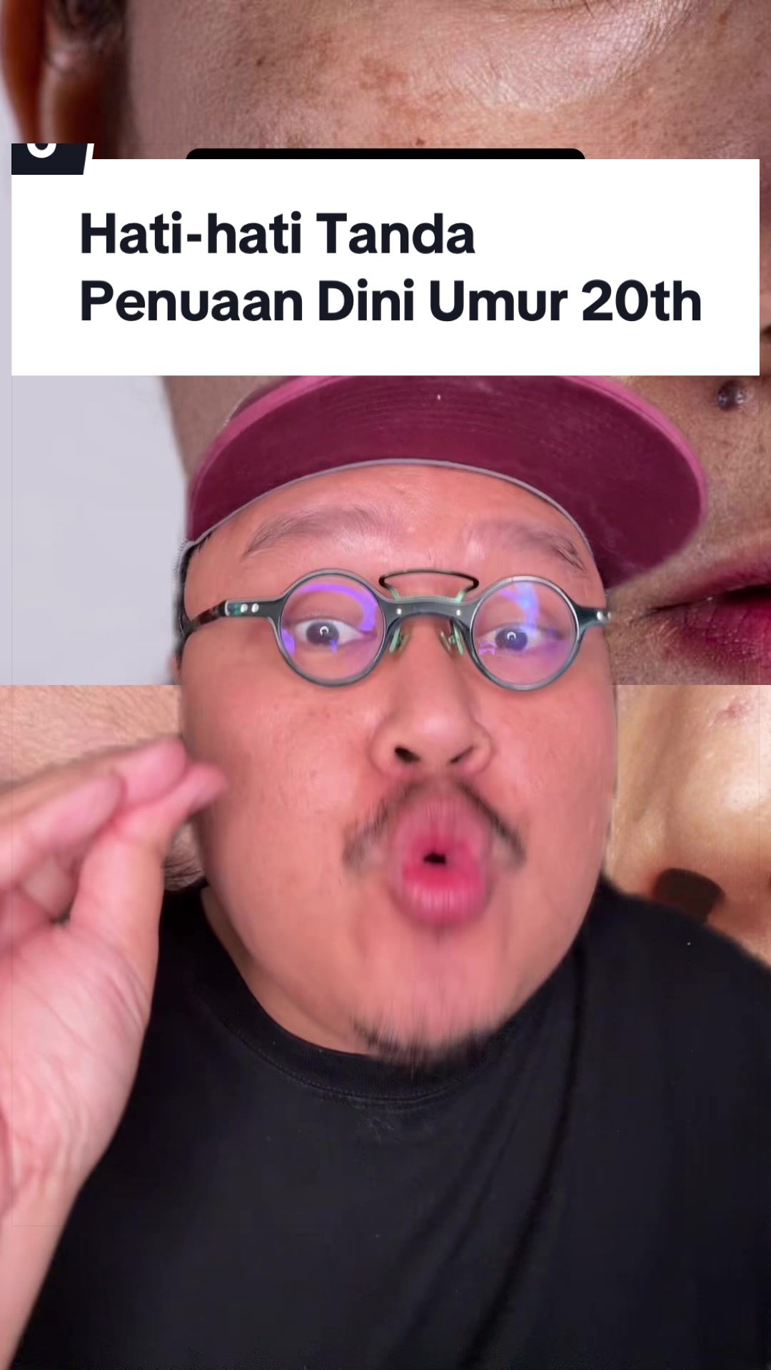 @Ali | @HungryForSkincare