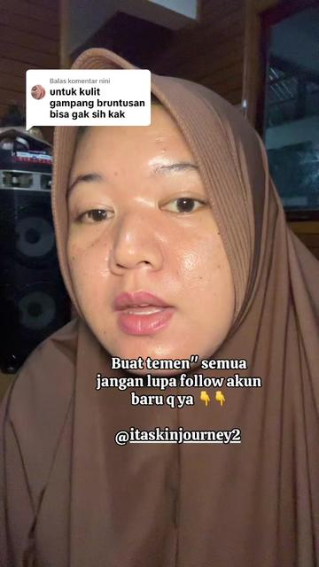 @ita_skinjourney