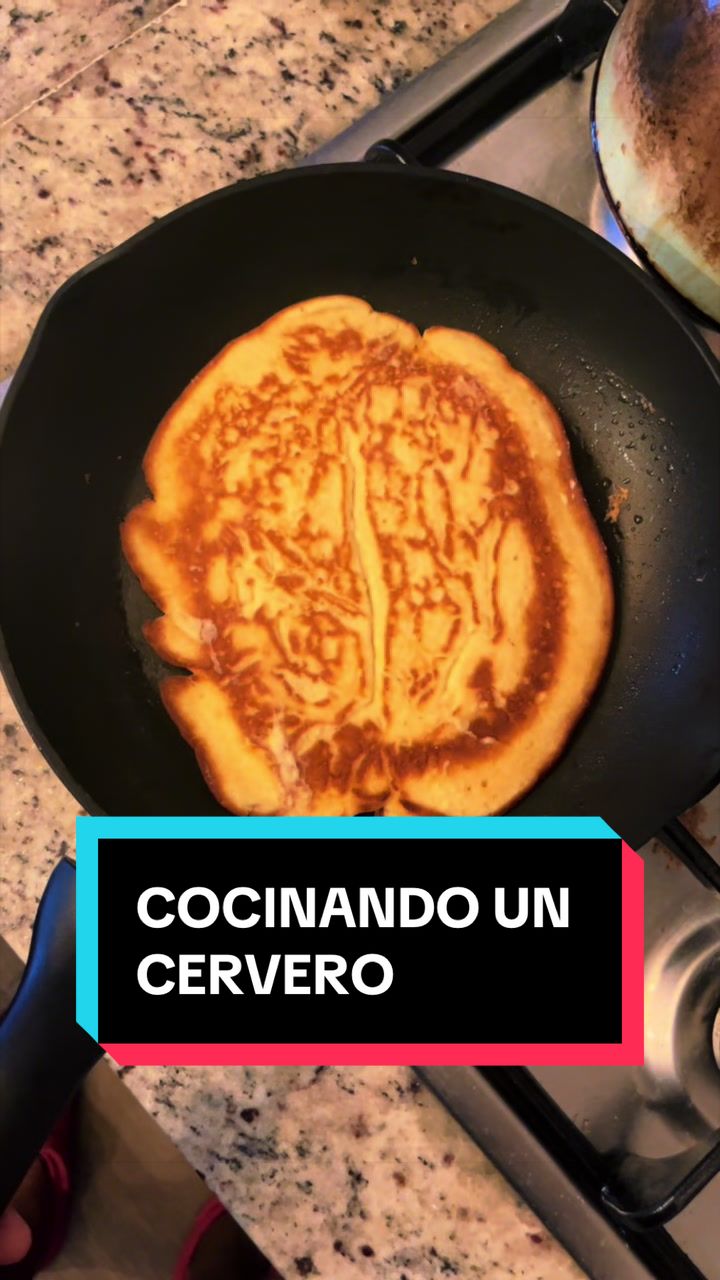 @Jhonabet 