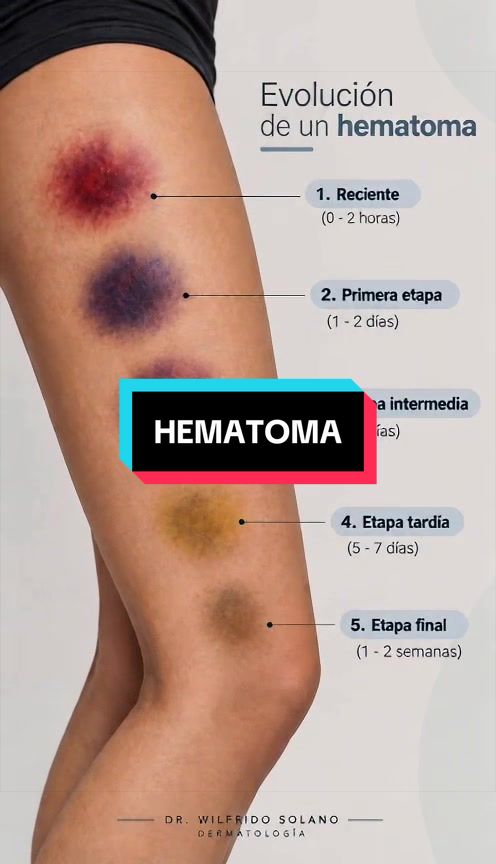 @Dr. Wilfrido Solano Derma