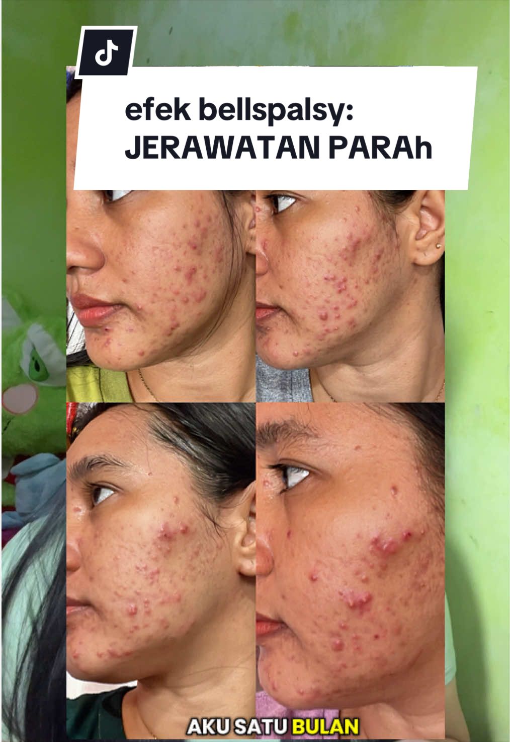 @Ernita🌼 | si kakak Bellspalsy