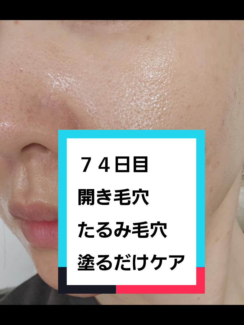 @リアル毛穴改善記録