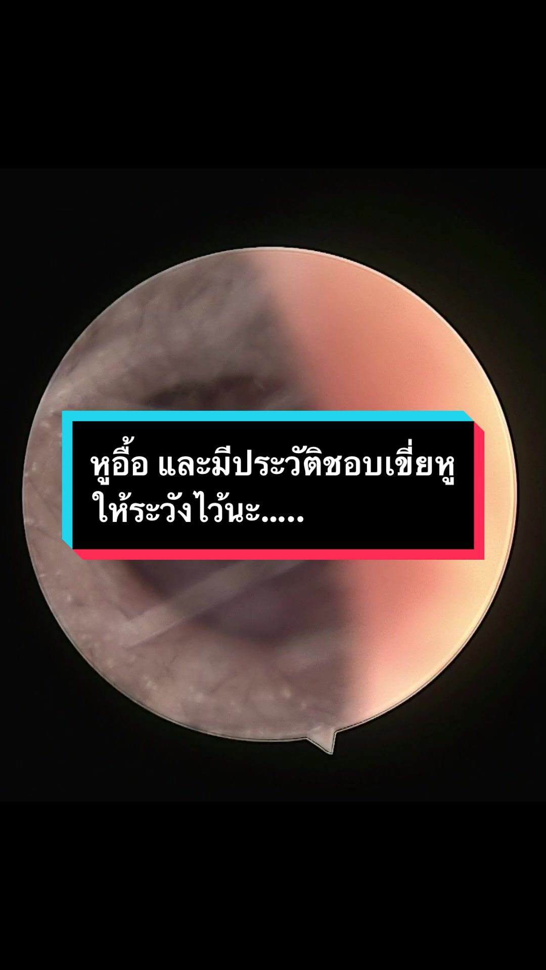 @คลินิกหมอณัฐธยาน์ หู คอ จมูก