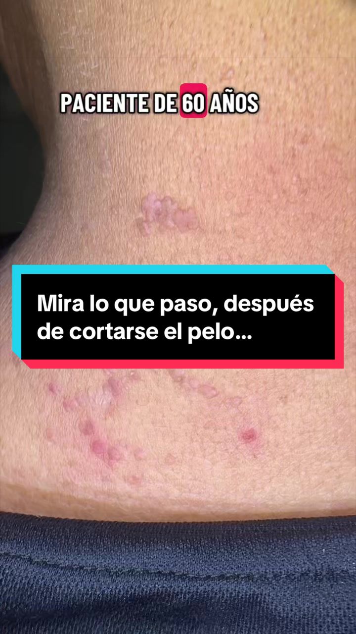 @Dr. Wilfrido Solano Derma