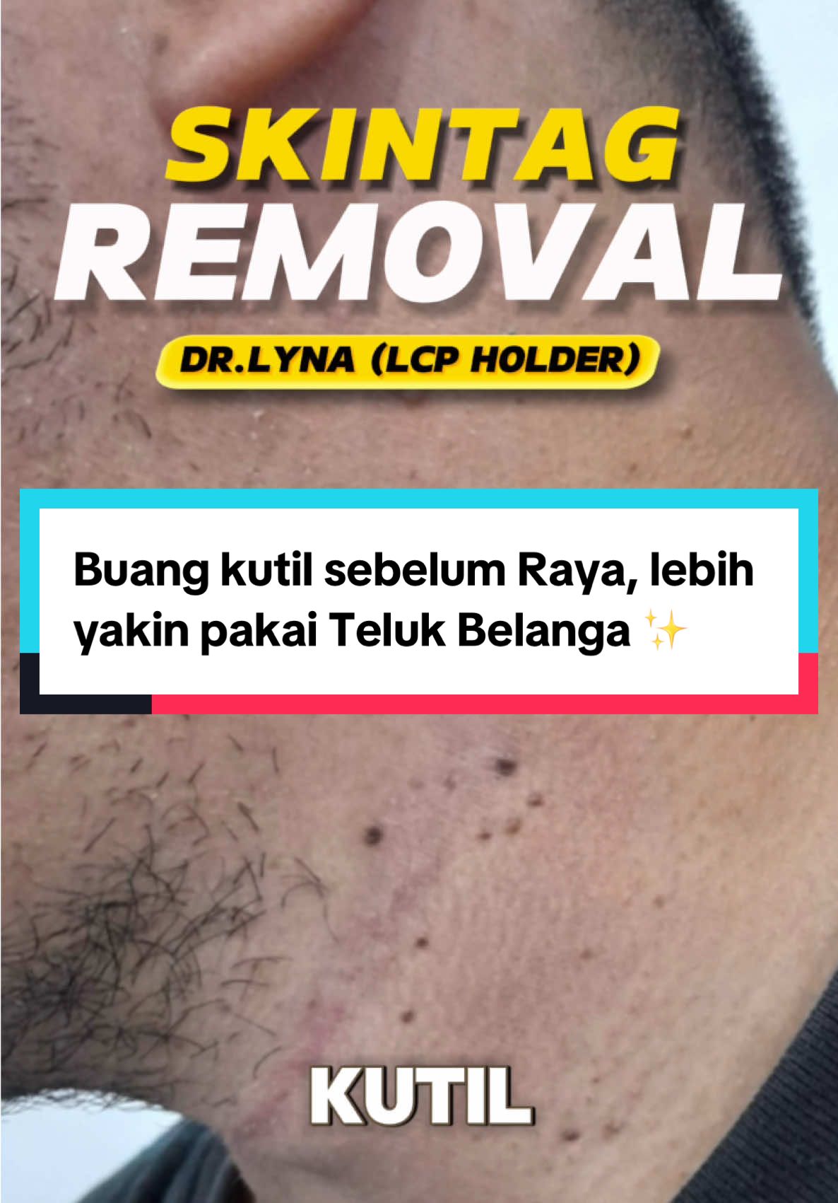 @Dr.Lyna Kulit.Aesthetic.Laser