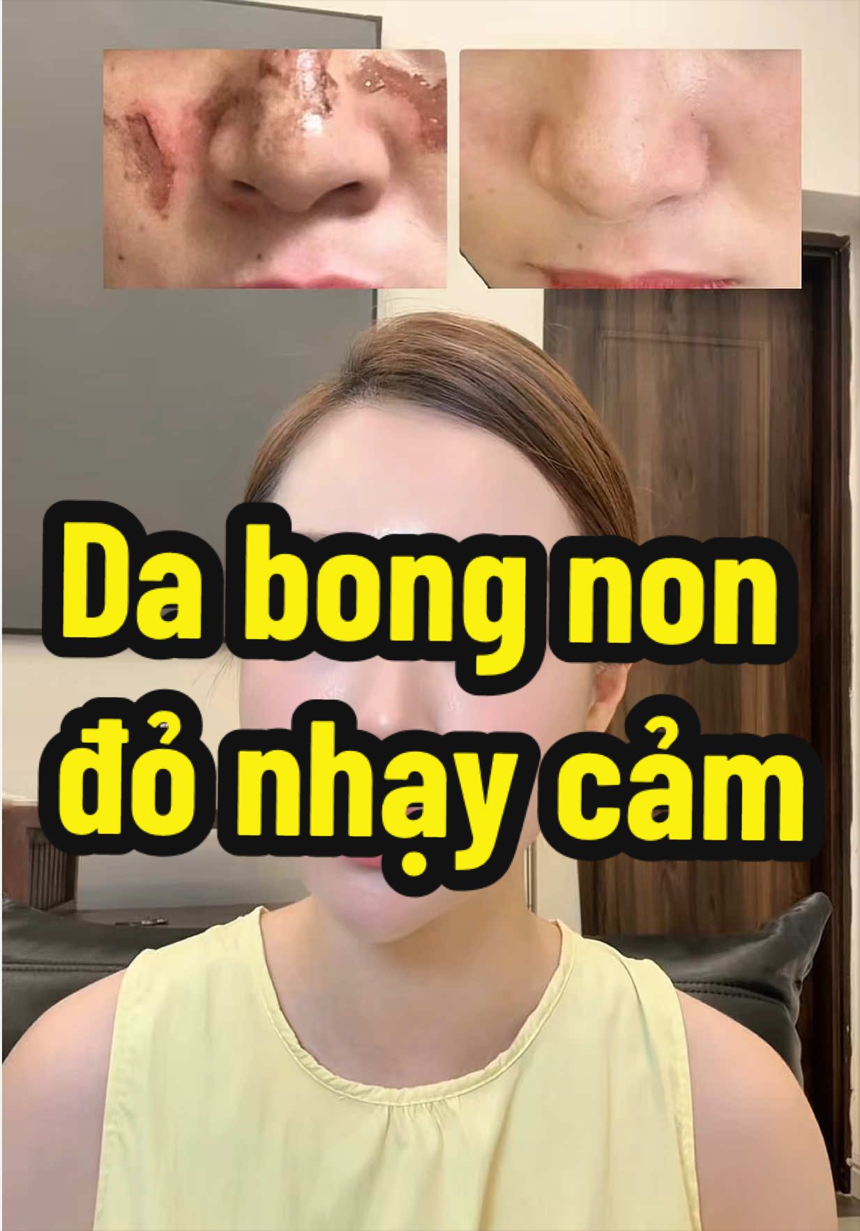 @Hồng Nhung nun