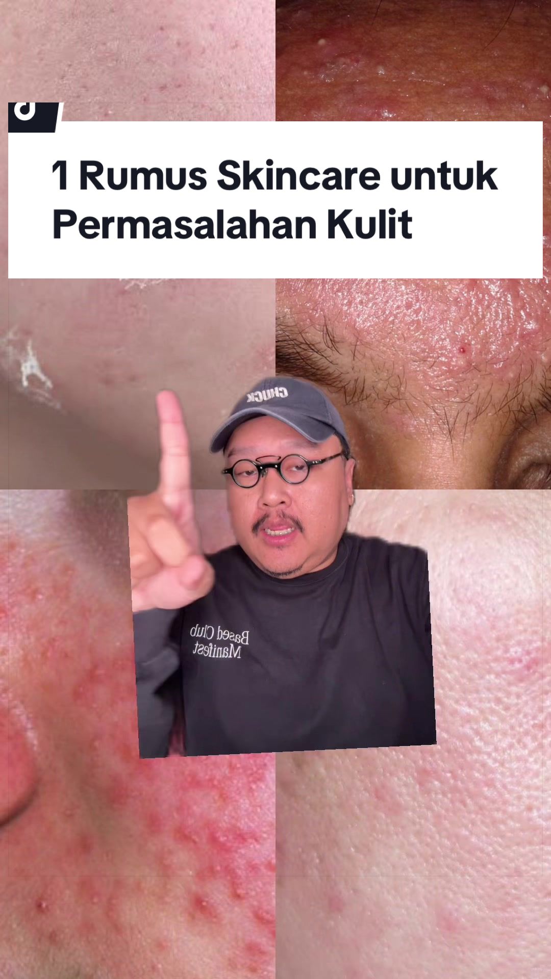 @Ali | @HungryForSkincare