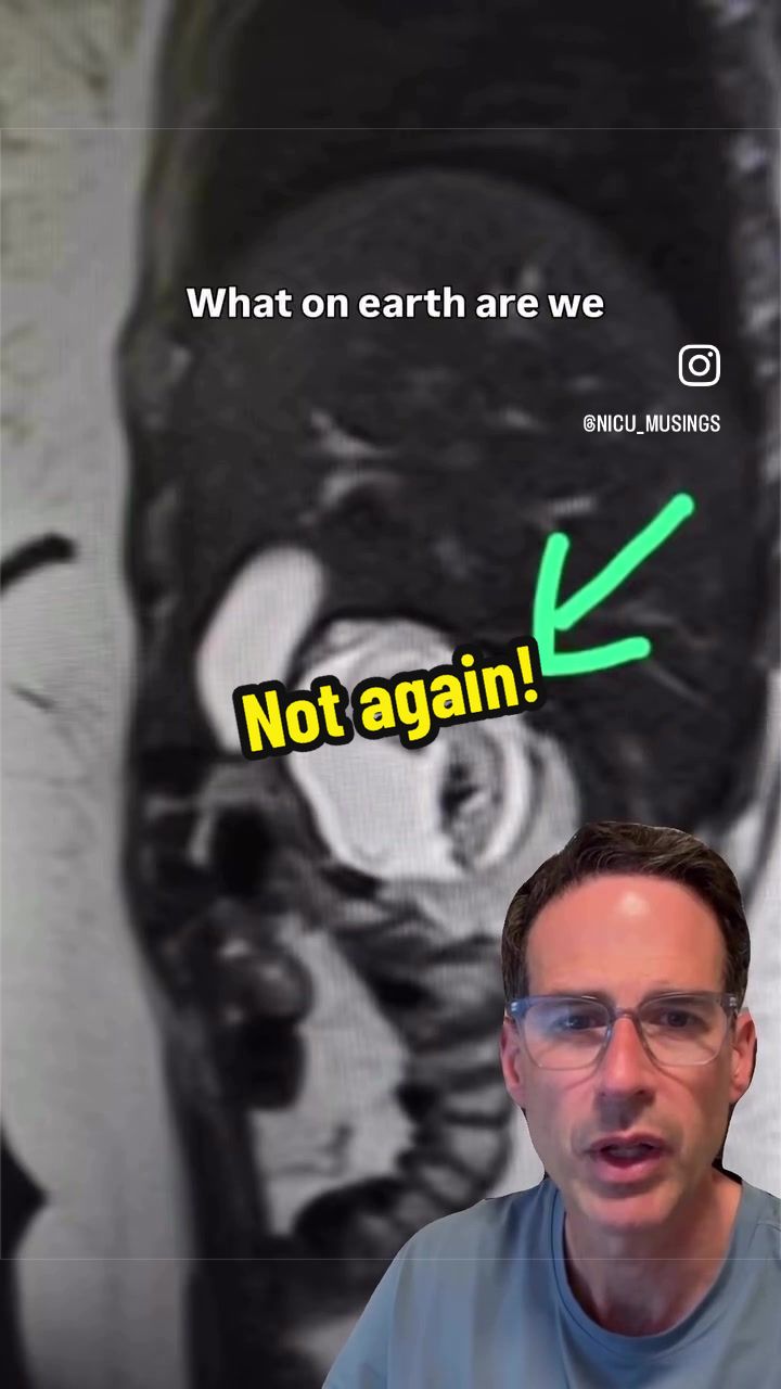 @Dr Michael Narvey 🇨🇦