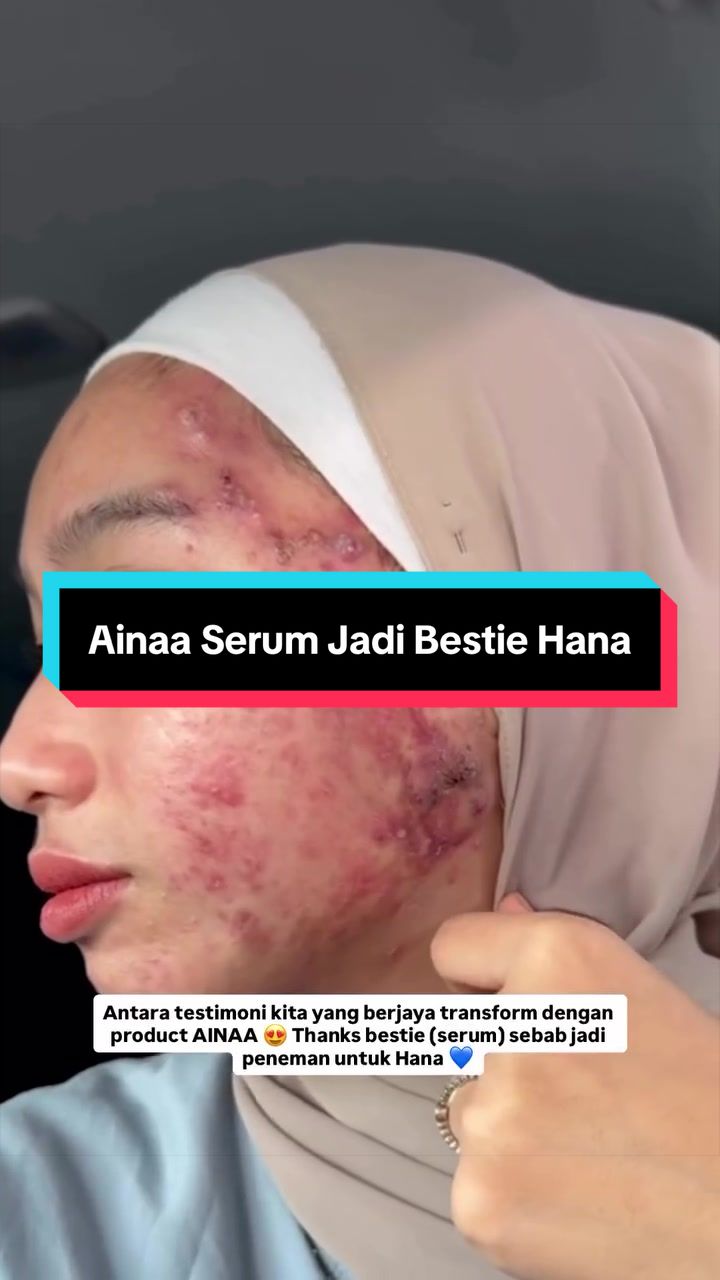 @Ainaa Beauty Original