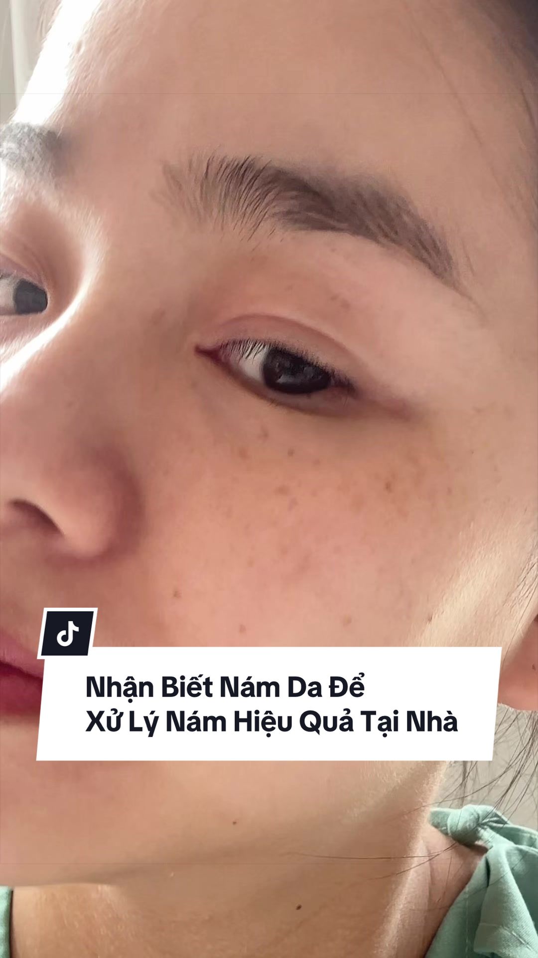 @Quin Skincareholic