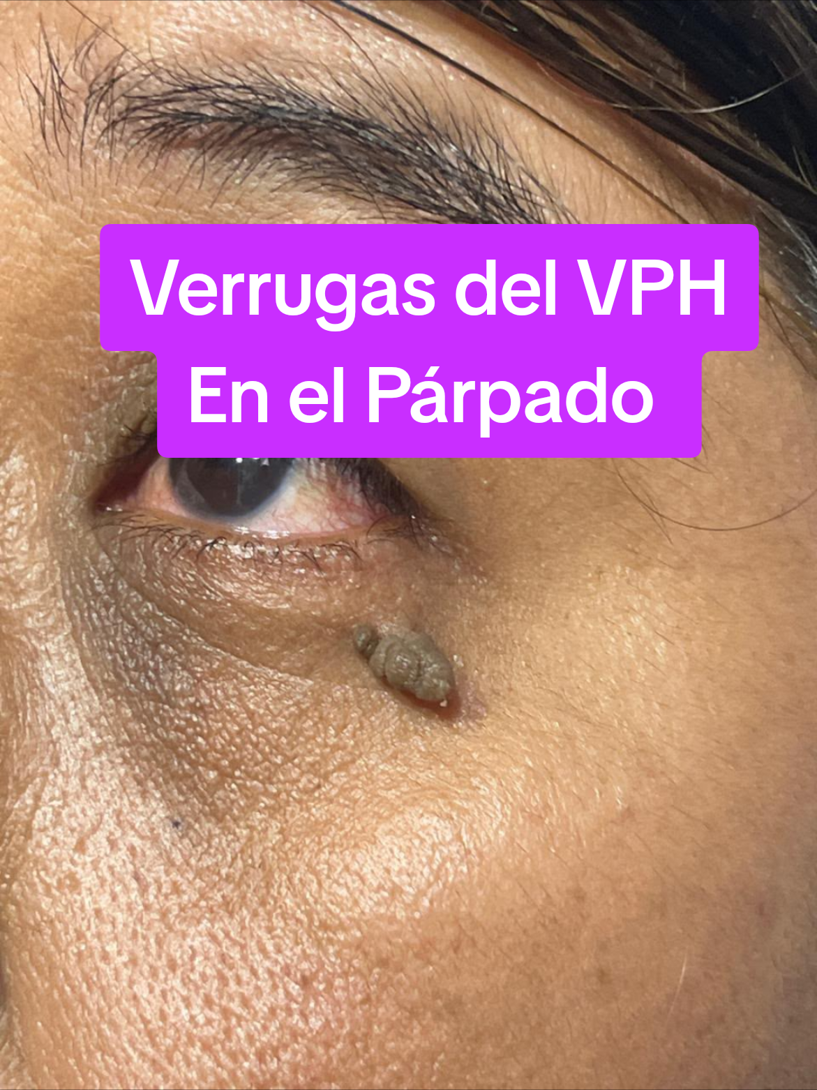 @VPH2025