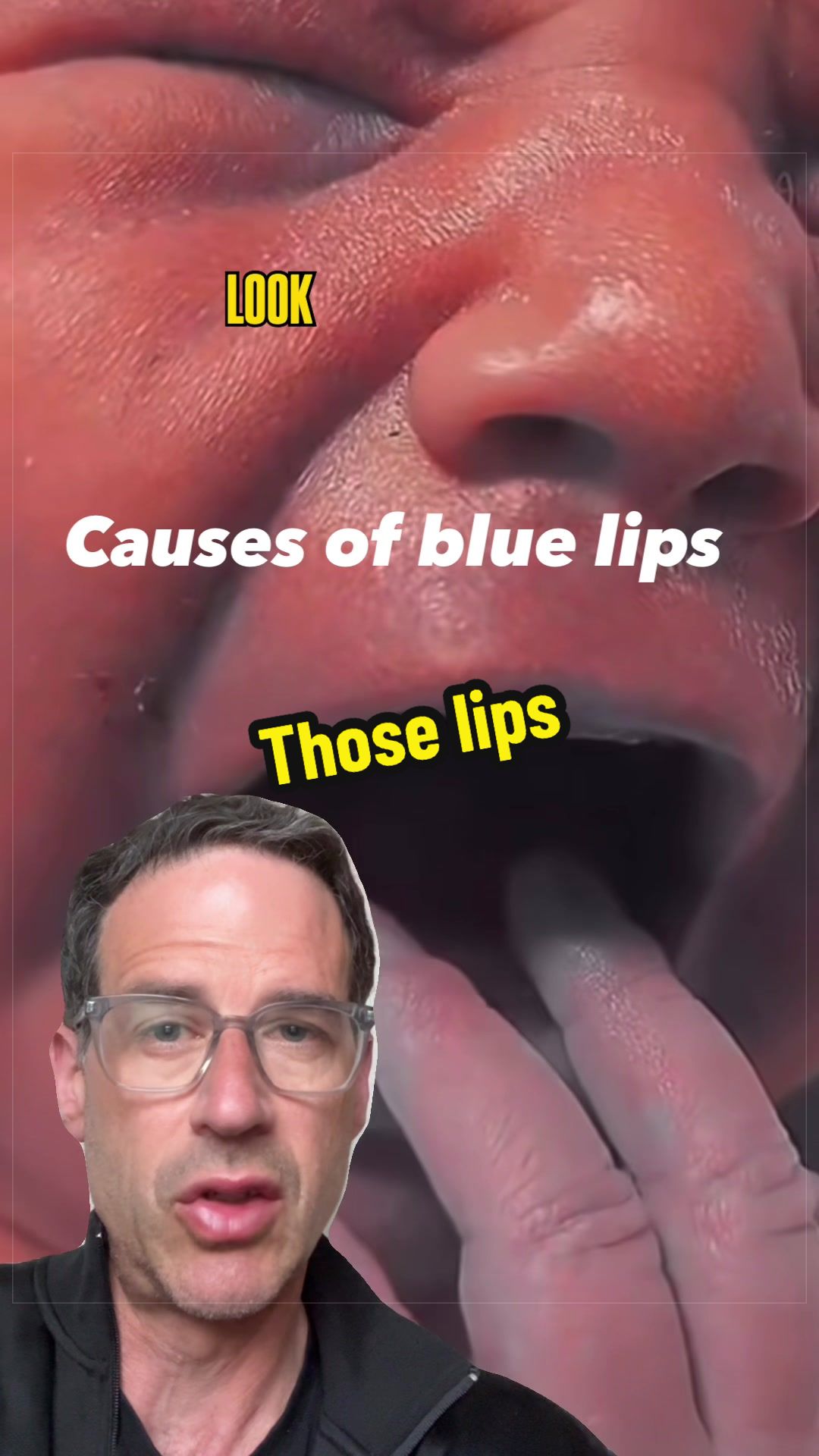 @Dr Michael Narvey 🇨🇦