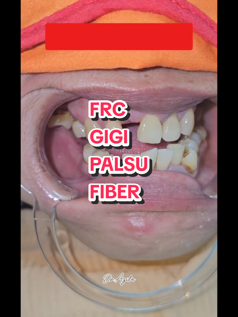 @Dr. Azila