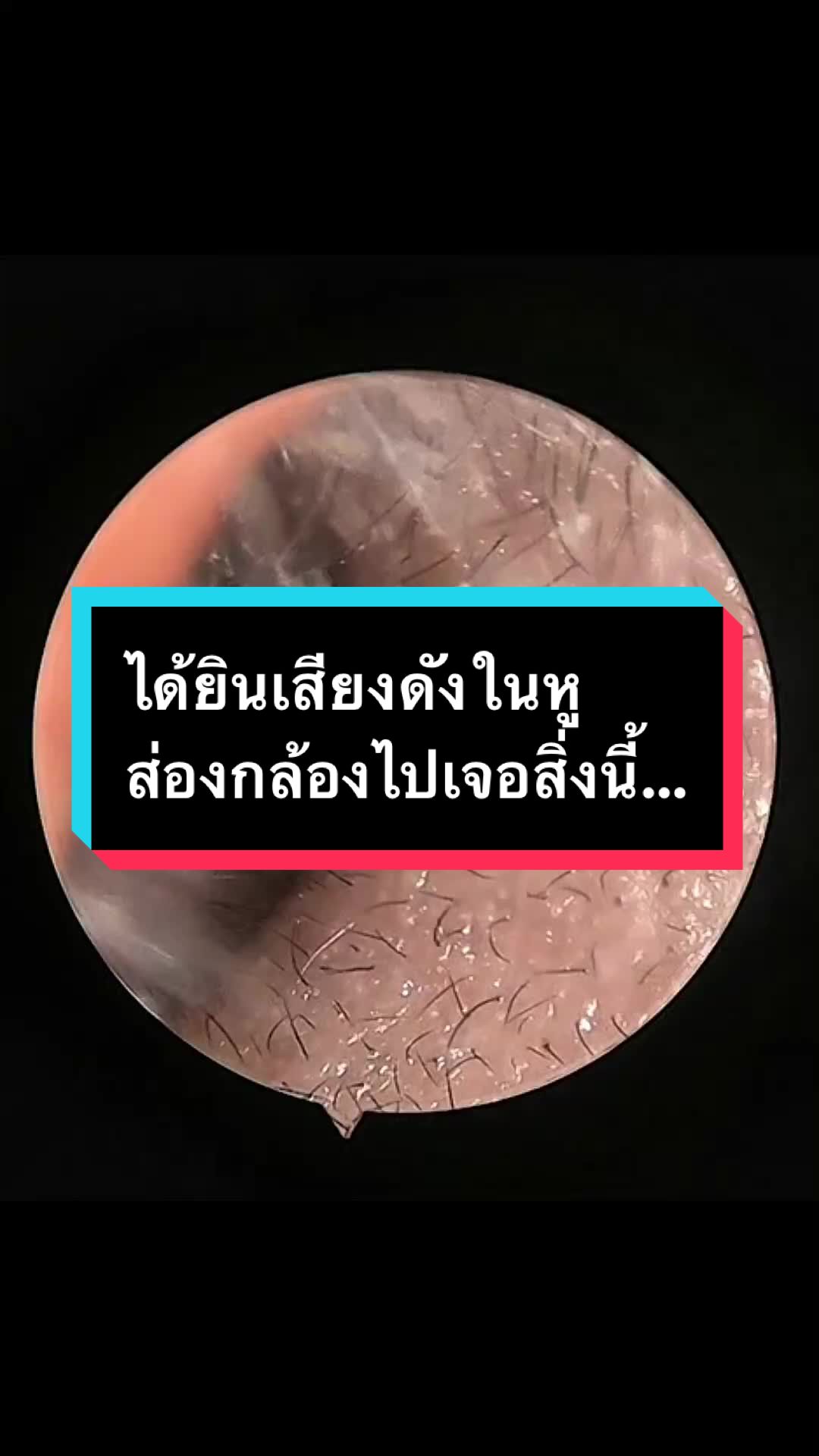 @คลินิกหมอณัฐธยาน์ หู คอ จมูก