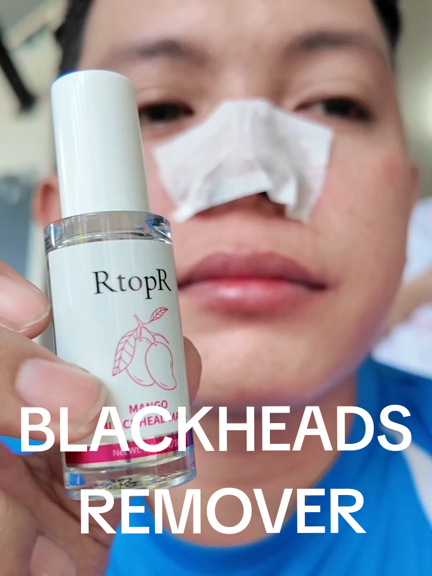 @Ranzkie Tutorial