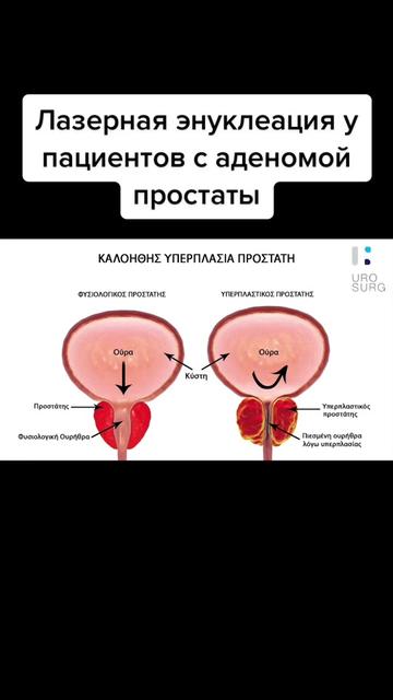 @Denis Davydov