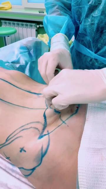 @АБИА
