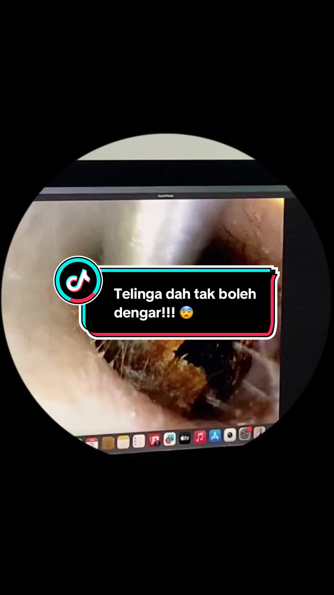 @Klinik Primer Cherang BP