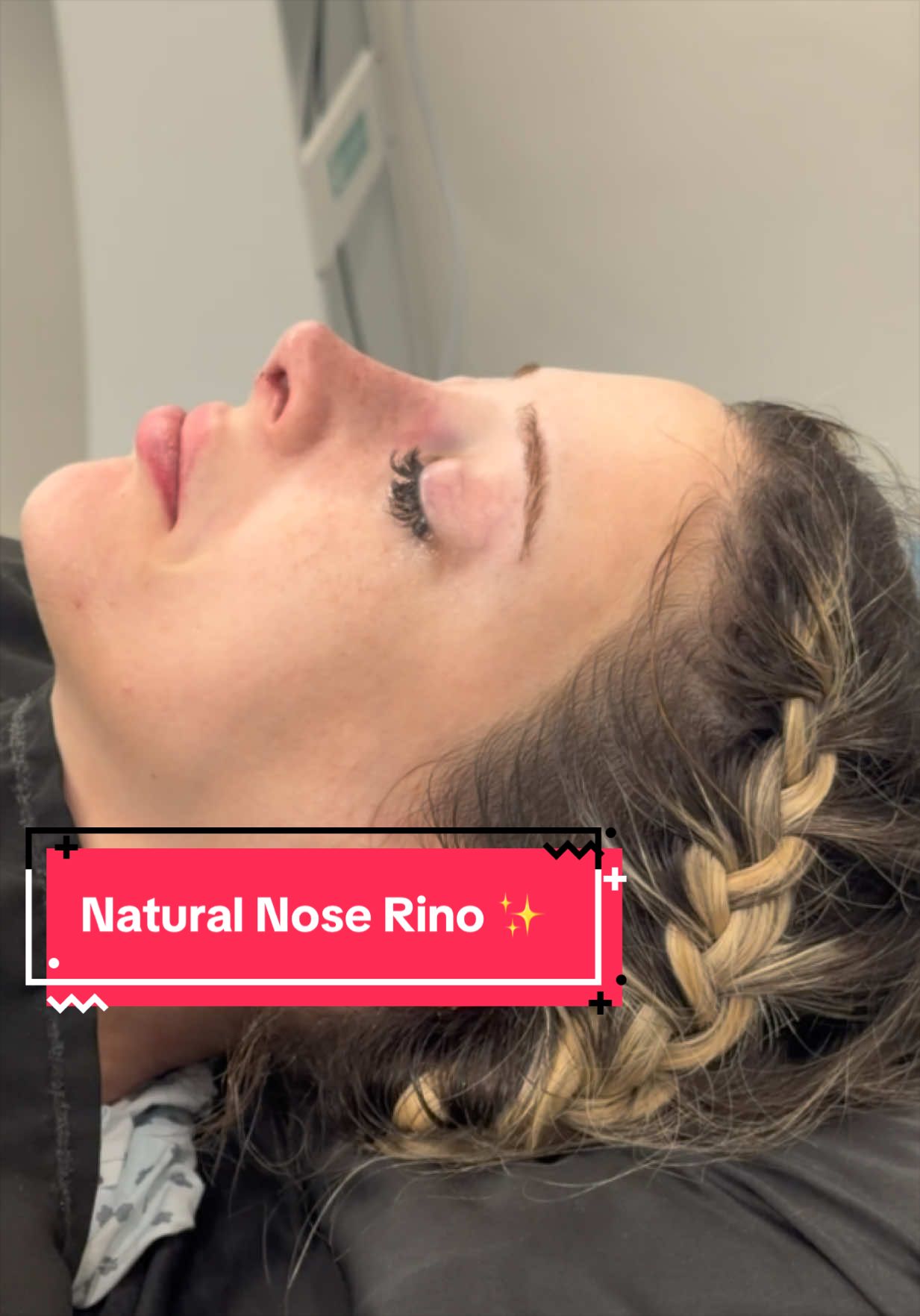 @drgarone.rinoplastia