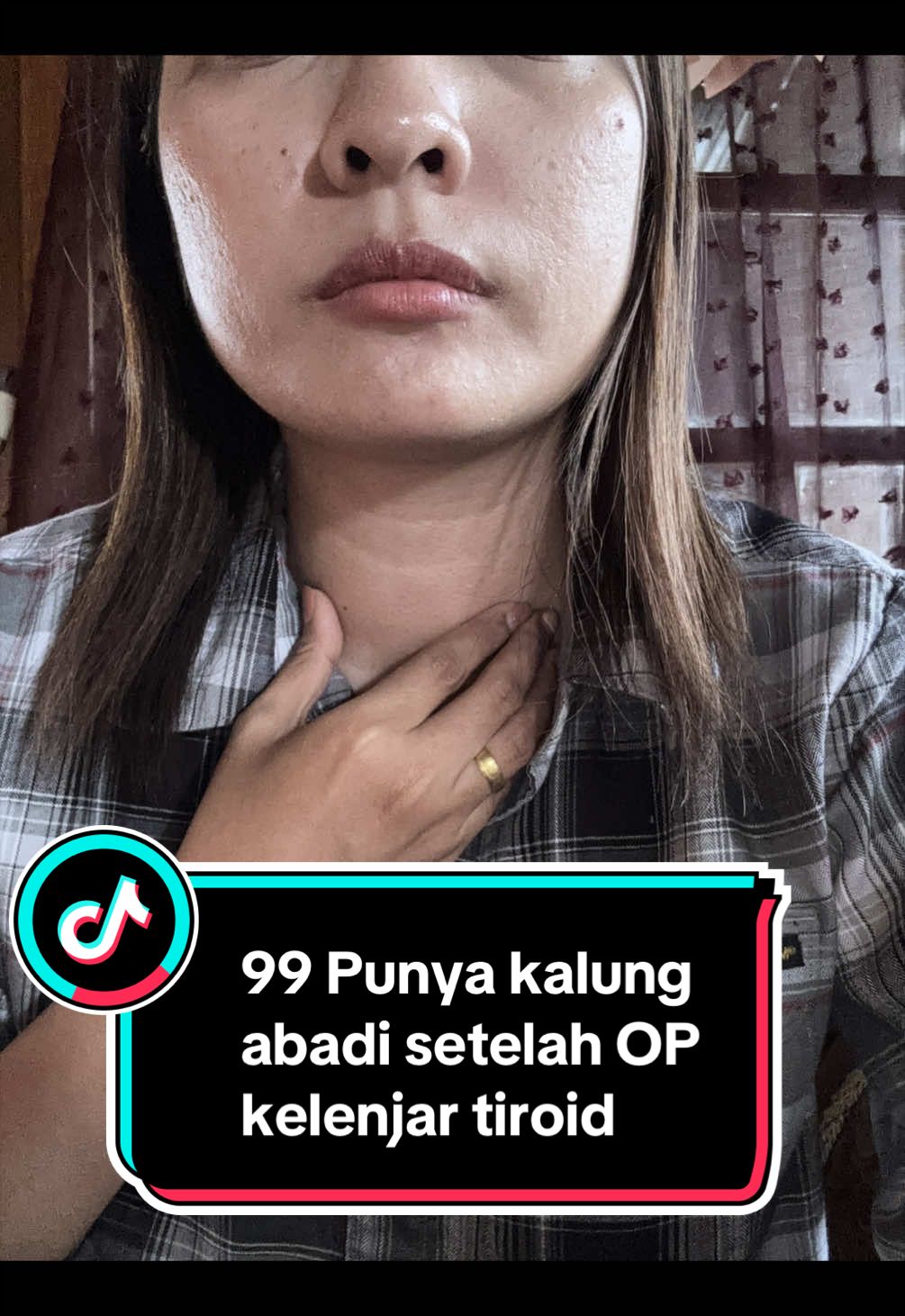 @Fionalois Pertiwi