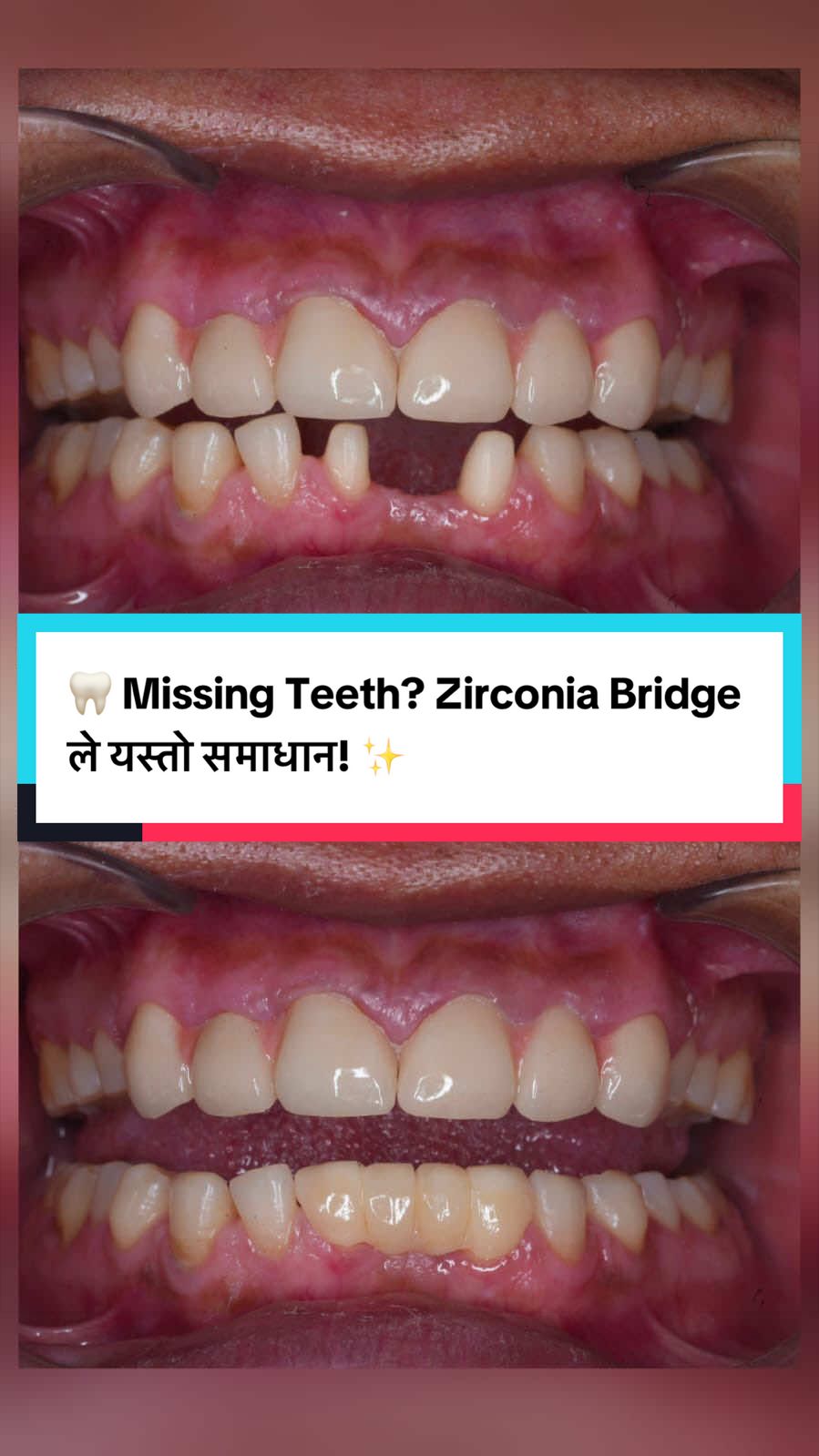 @Smile Engineer Dr Bidhan